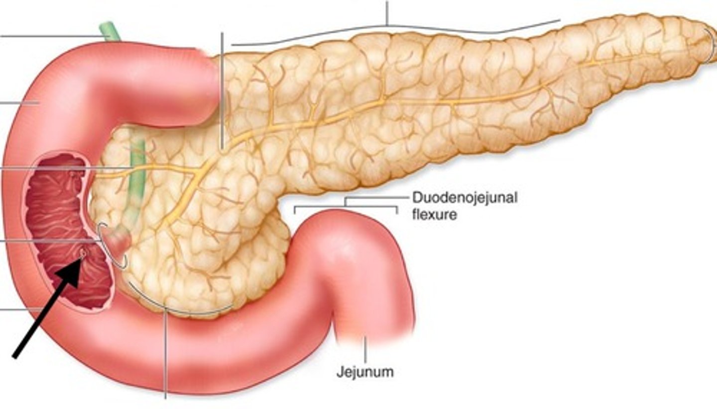 <p>the raised area where the common bile duct and pancreatic duct enter the duodenum</p>