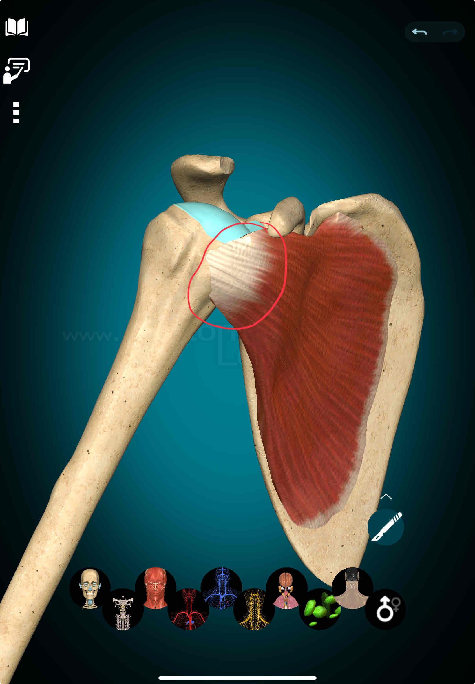 <p>Subscapularis Insertion</p>