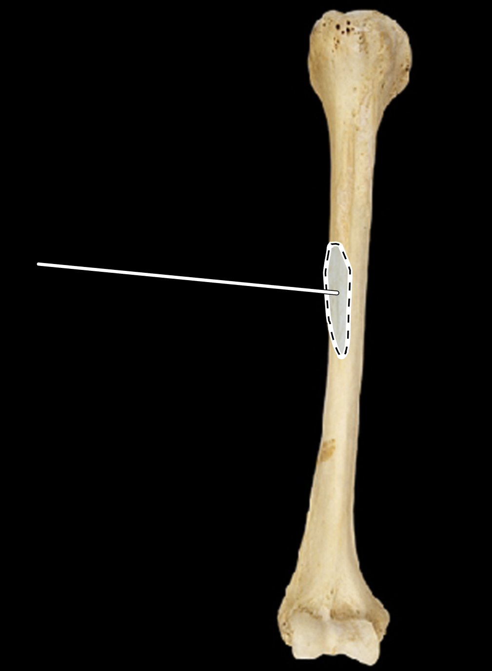 <p>Name the highlighted portion.</p><p>(Anterior view).</p>
