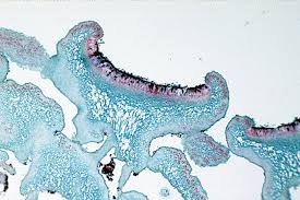 <p><span>Algal vs fungal cells</span></p>