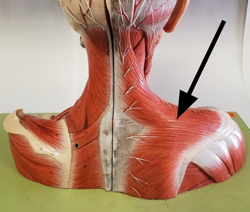 <p>Name the muscle indicated by the arrow</p><p>View: Posterior side, superficial layer</p>
