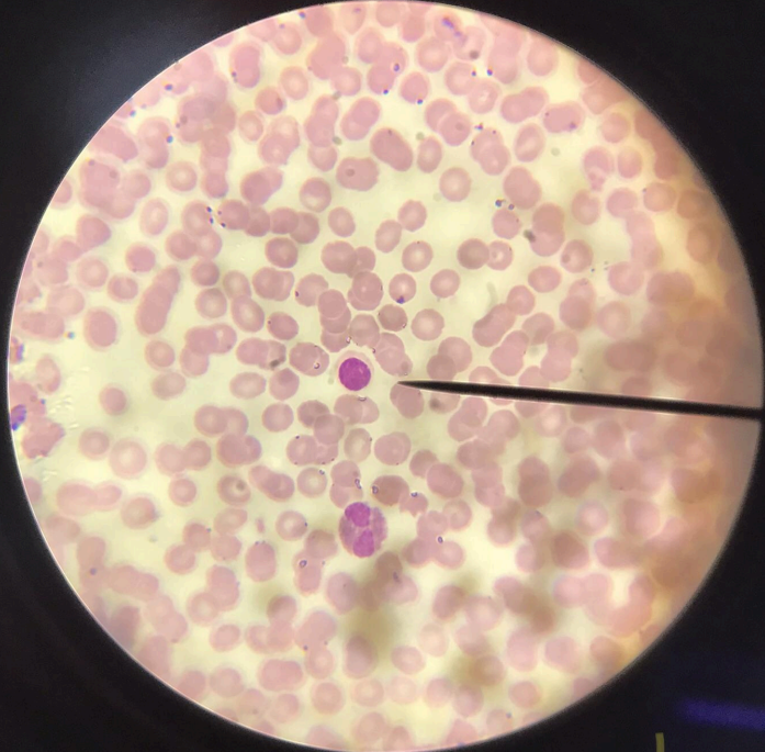 <p>a type of agranulocyte; larger than erythrocytes; big nucleus which stains deep blue; mechanism of immunity</p>