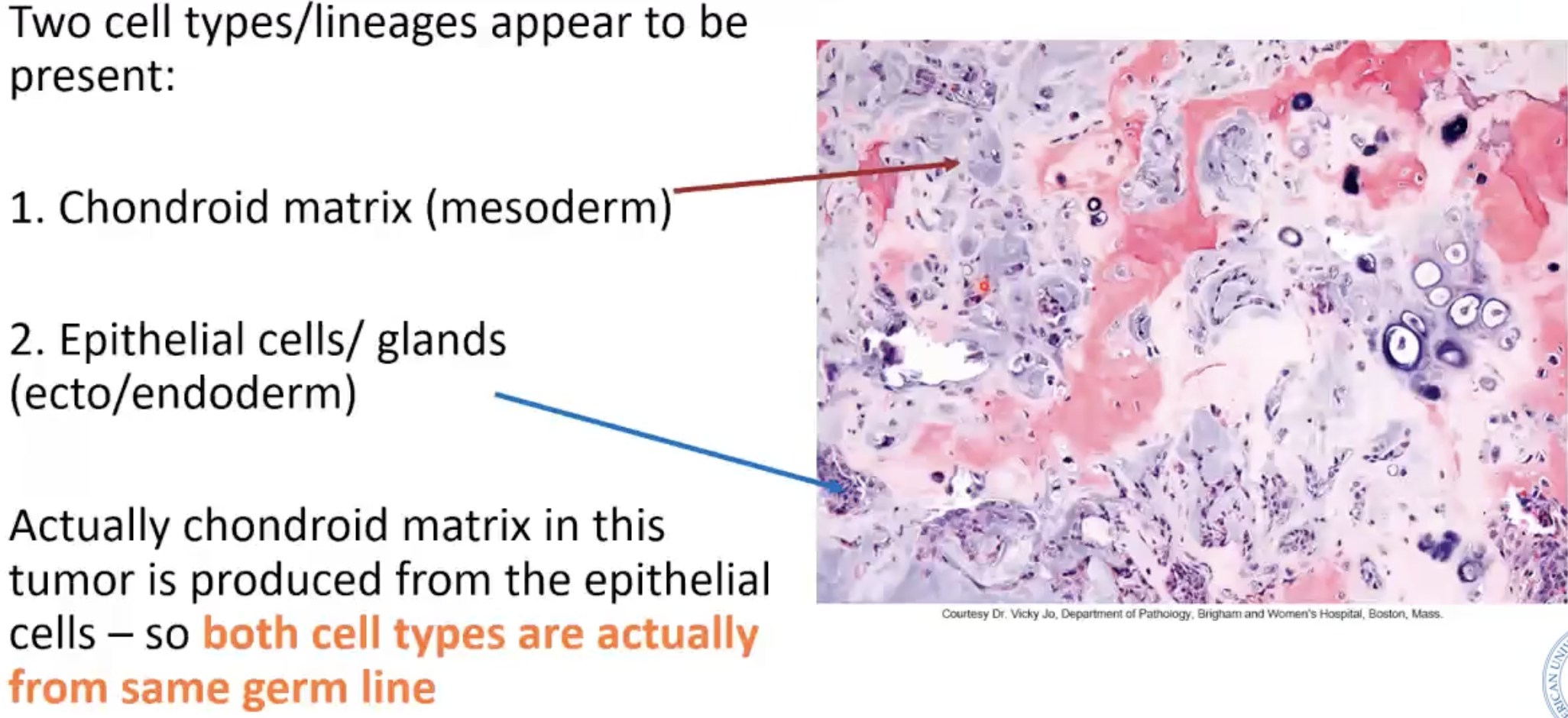 <ul><li><p>Also called = pleomorphic adenoma (benign)</p></li><li><p>Two cell types/lineages appear to be present&nbsp;</p></li></ul><p></p>