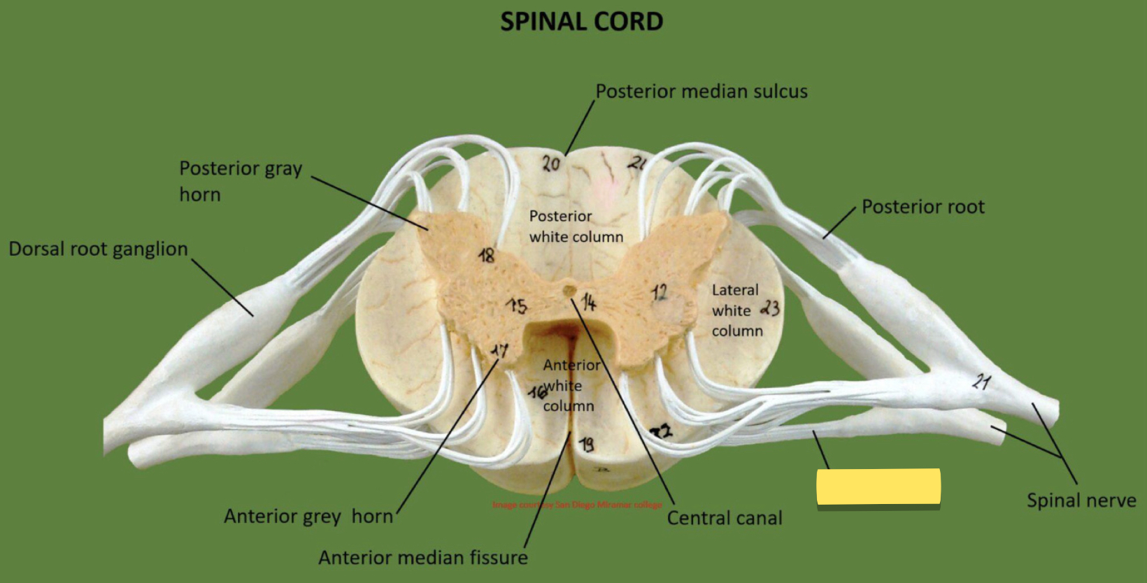 <p>Name this spinal cord part</p>