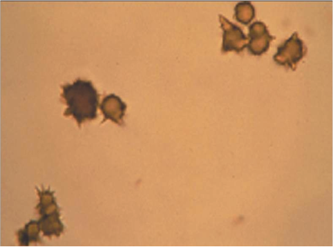 <p>Ammonium biurate</p>