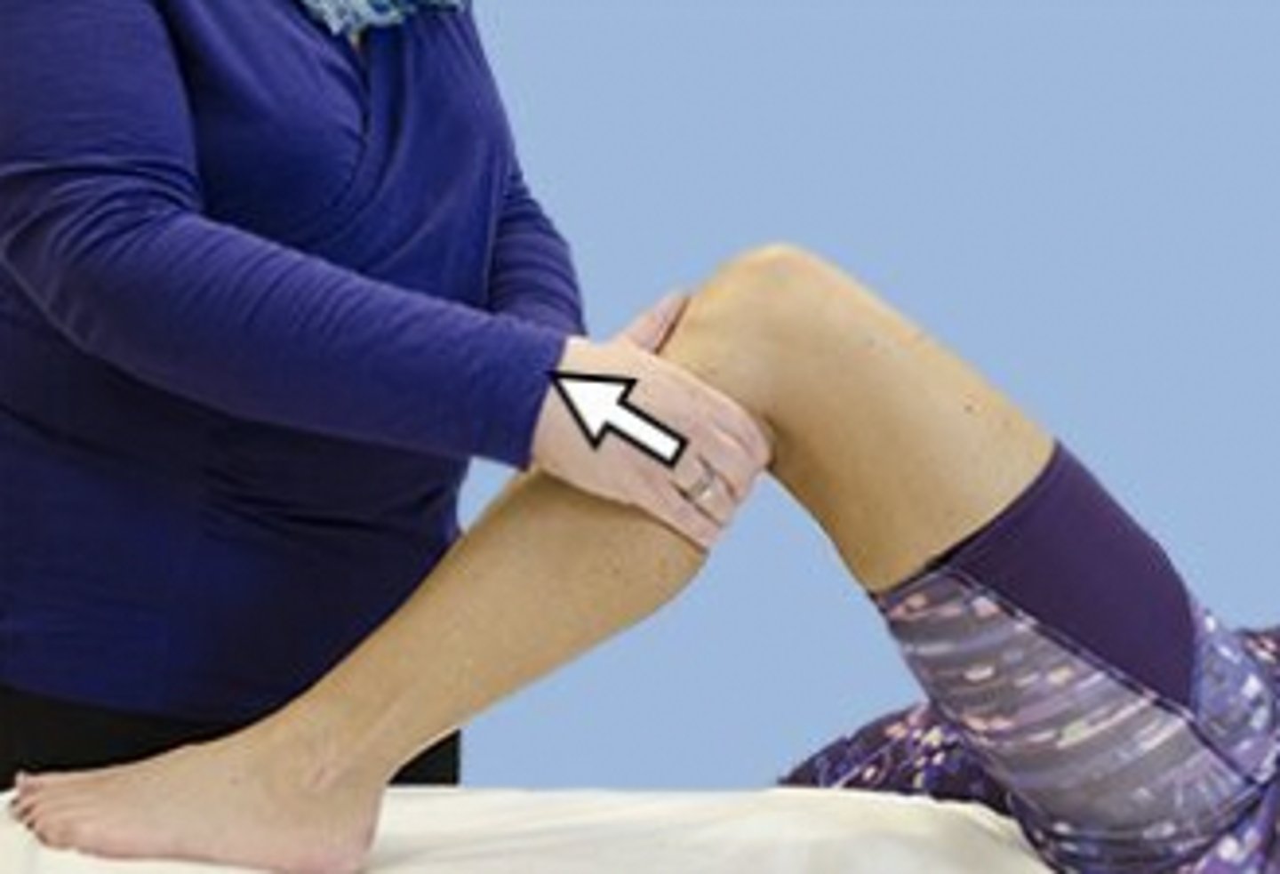 <p>Rationale</p><p>1. The photograph shows the anterior drawer test for the knee, which is used to assess the integrity of the anterior cruciate ligament. Closed kinetic chain extension exercises will put less stress on the anterior cruciate ligament and are appropriate for the subacute phase (week 4) of treatment.</p><p>2. Open kinetic chain knee extension, especially the last 25°, will put increased tension on the anterior cruciate ligament.</p><p>3. Although straight leg raises put no stress on the anterior cruciate ligament, this would be an exercise for the acute (not subacute) phase of treatment.</p><p>4. Plyometric exercises are an important part of the functional phase (week 10) of rehabilitation after an anterior cruciate ligament tear.</p>
