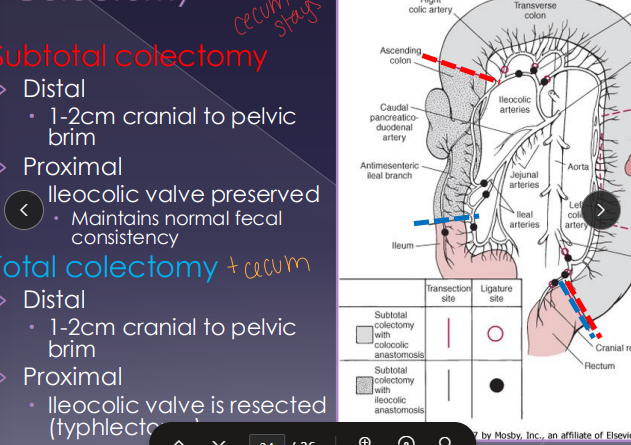 <p><span>Surgical Procedures within the Large Intestine</span></p>
