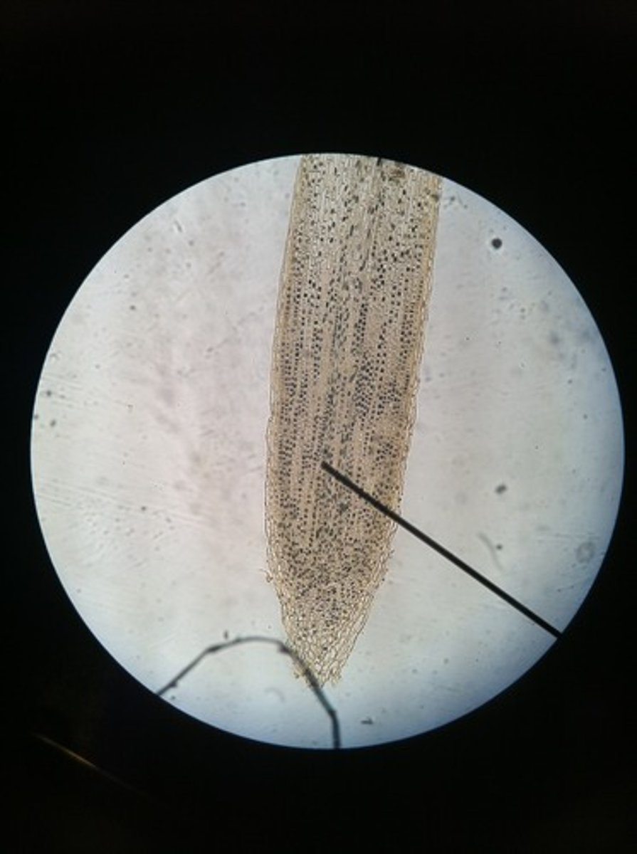 <p>grid-like cells, all have nucleus, some undergoing mitosis</p>