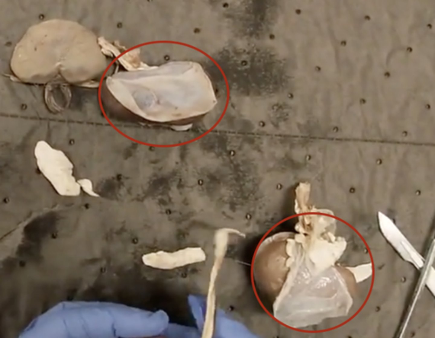 <p>Thin tissue covering the kidney's external surface.</p>