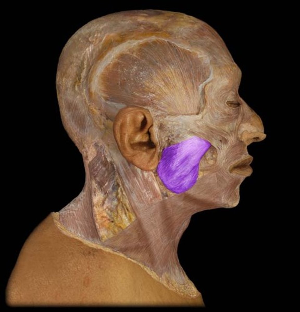 <p>elevation and protraction of mandible</p>
