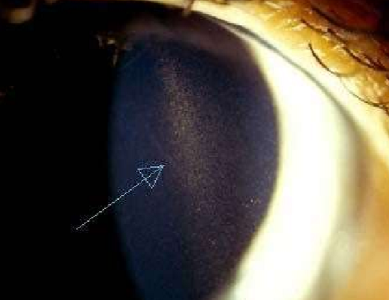 <p>What condition is this?</p>