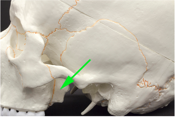 <p>What part of the sphenoid bone is marked by the green arrow?</p>