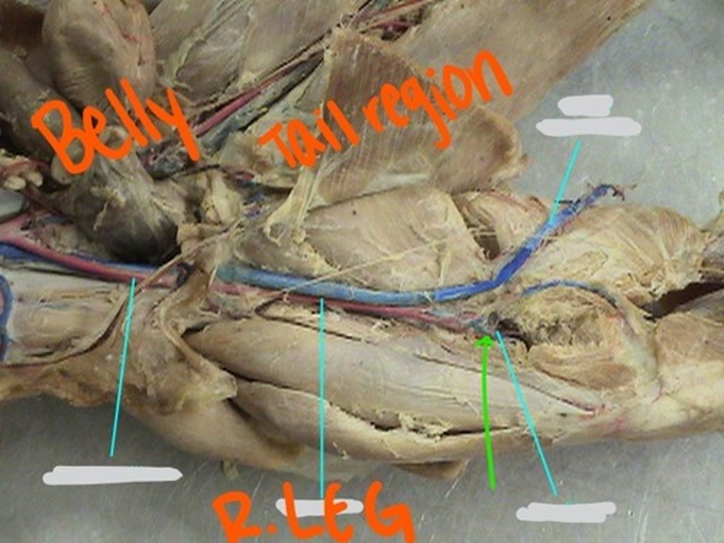<p>identify this artery</p>