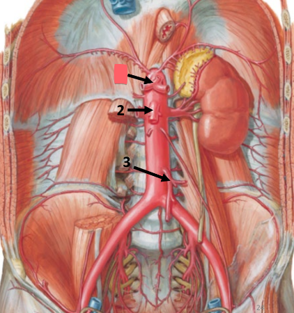 <ul><li><p>left gastric artery</p></li><li><p>common hepatic artery</p></li><li><p>splenic artery</p></li></ul><p>supplies esophagus, stomach, spleen, liver, gallbladder</p><p>summary: most upper quadrant organs</p><p></p>