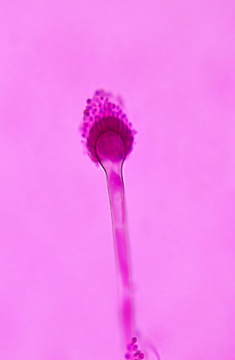 <p>Aspergillus fumigatus produces uniserate phialides bearing chains of round conidia. The phialides are located only on the upper portion of the vesicle.</p>
