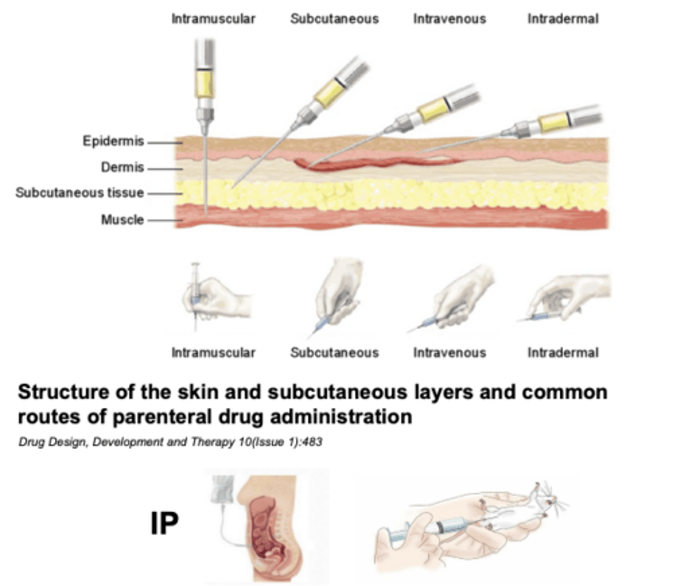 <p>1. Intravenous (IV)</p><p>2. Intramuscular (IM)</p><p>3. Subcutaneous (SC)</p><p>4. Intradermal (ID)</p><p>5. Intraperitoneal (IP) - injection of a substance into the peritoneum (body cavity).</p>