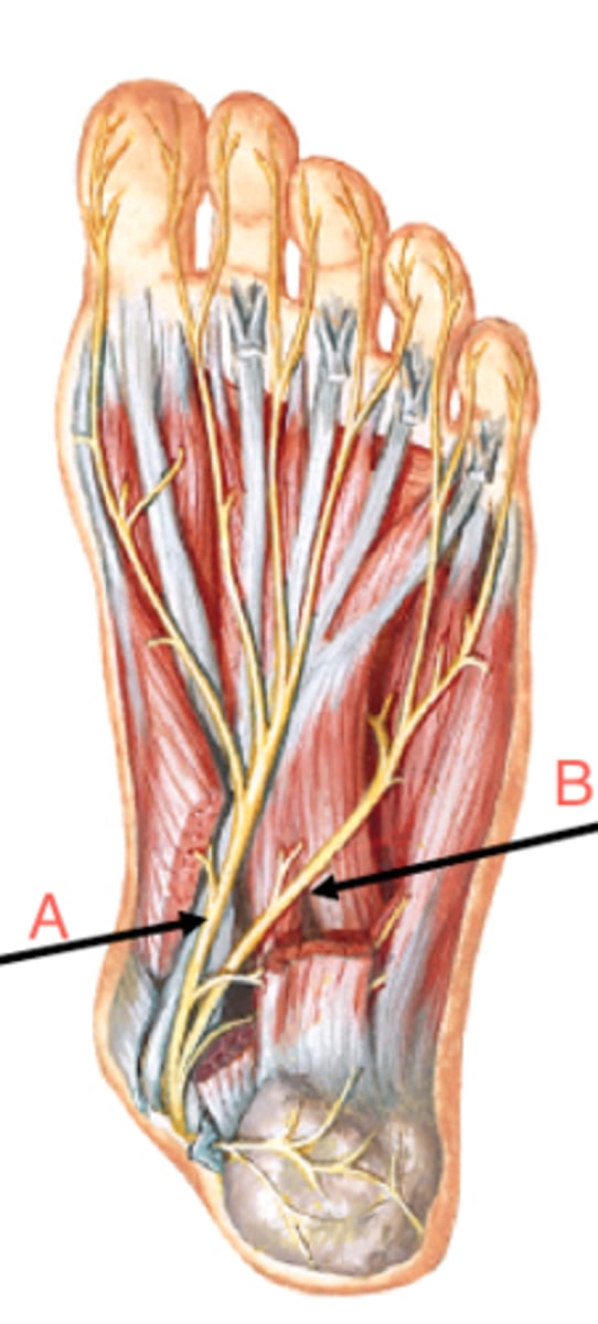<p>B (innervates more muscles)</p>