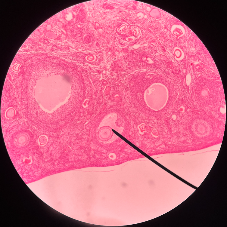 • Surrounds an oocyte in the ovary.

• Secretes estrogen.

• Also known as a granulosa cell.