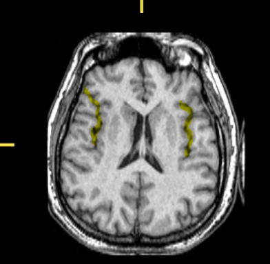 <p>What part of the brain is highlighted?</p>
