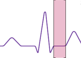 <p>between the end of ventricular depolarization and the beginning of ventricular repolarization (systole), plateau</p>