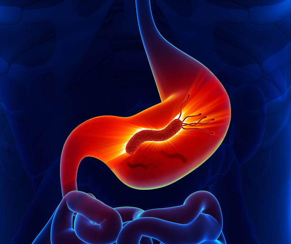 <p>Welke bacterie overleeft het maagzuur wél?</p>