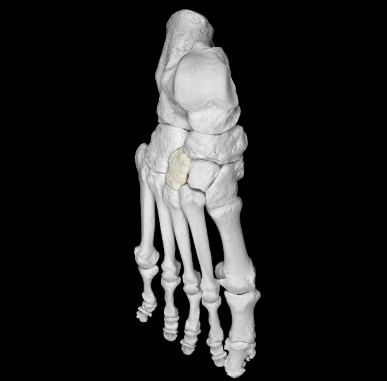 <p>tarsal posterior to metatarsal 3</p>