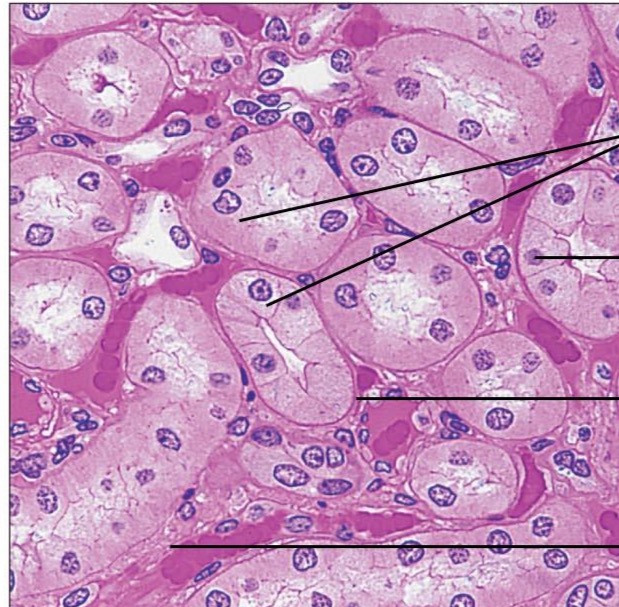 <p>What types of tissue is this</p>