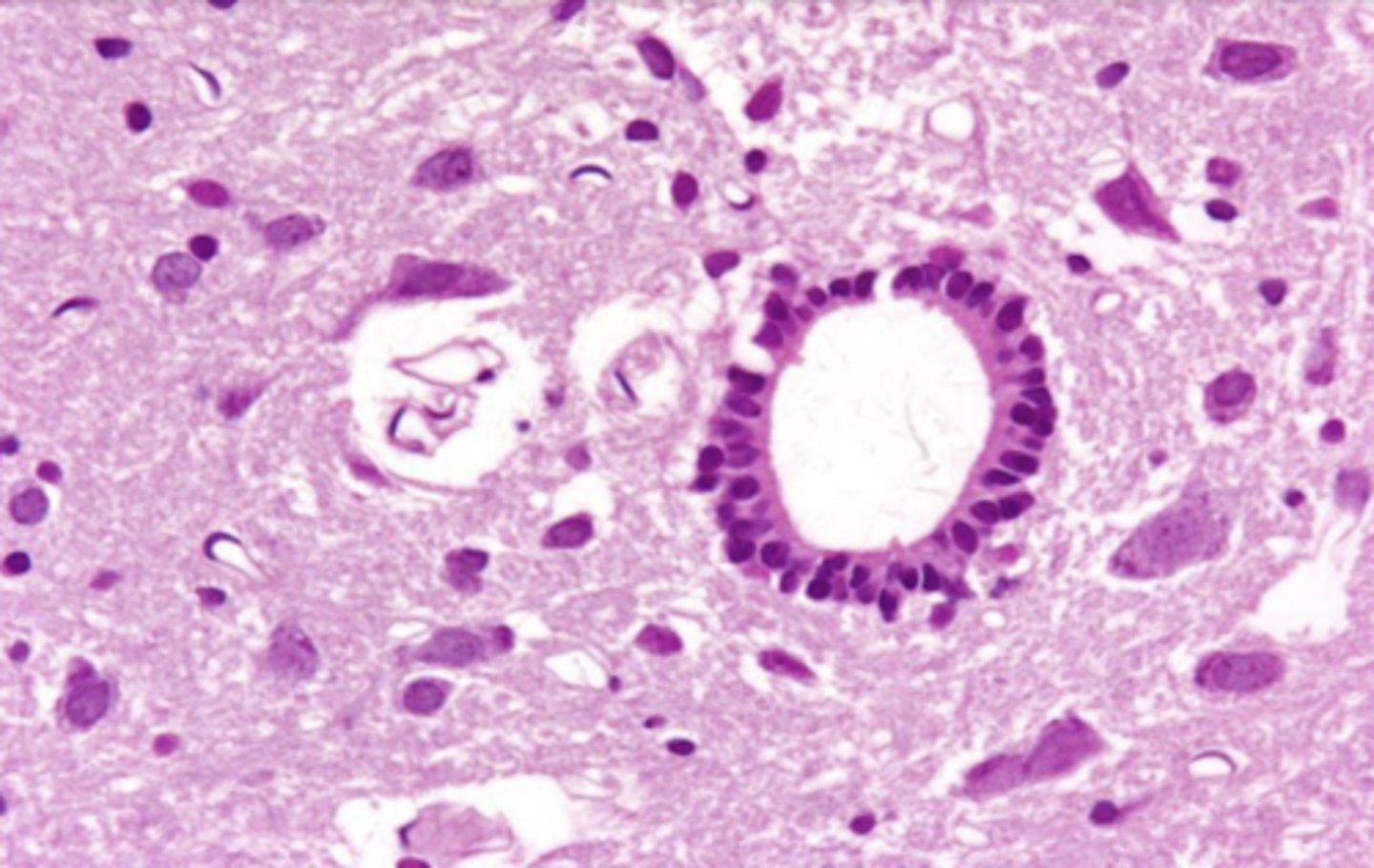 <p>what are these cells surrounding the central spinal cord?</p>