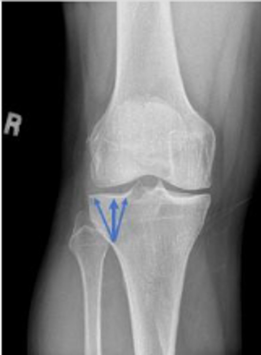 <p>What is outlined?</p>