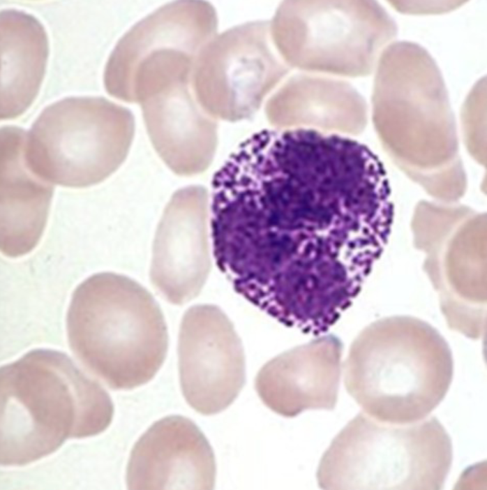 <p>what WBC is this?</p>