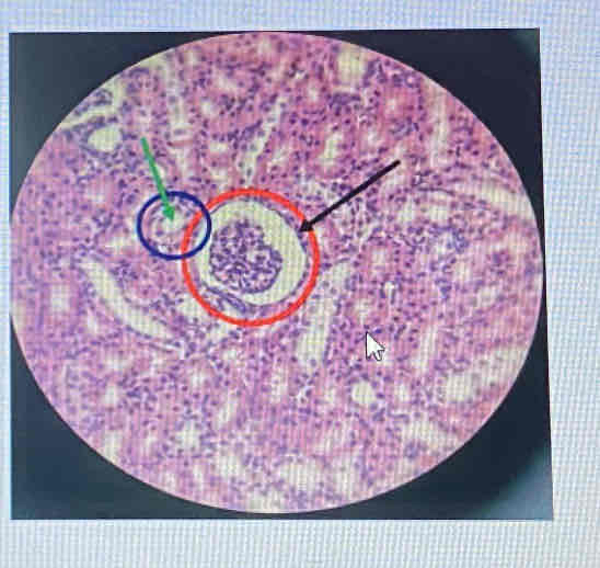 <p>What type of epithelium is pointed at by the green arrow that surrounded the lumen of tubule?</p>