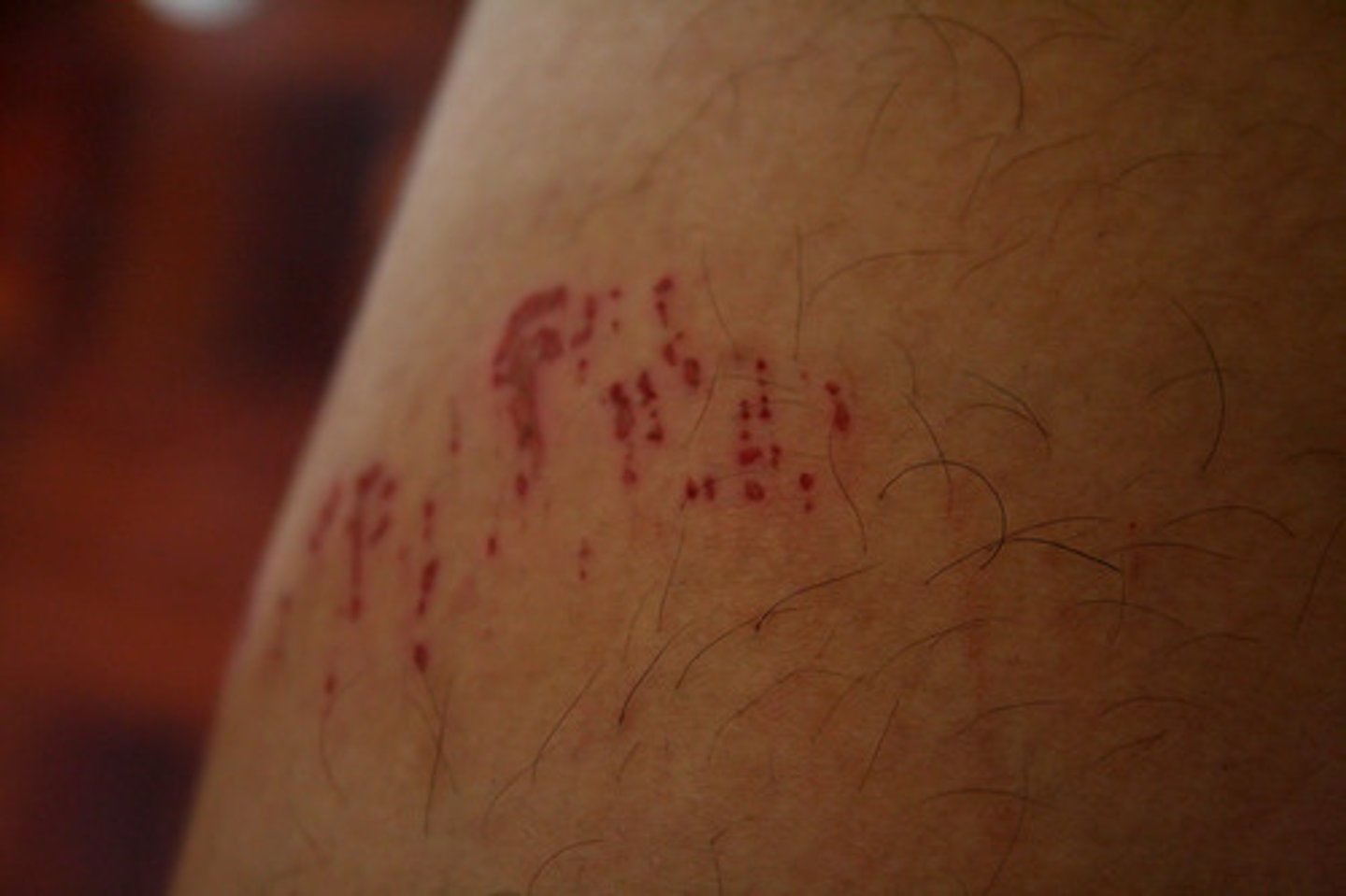 <p>Caused by a blunt object</p>