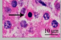 <p>shrunken cell</p><p>loss of adhesions to nearby cells and basement membrane</p><p>pyknotic, with chromatin condensed around periphery</p><p>no/minimal inflammation</p><p>cytoplasmic blebs = apoptotic bodies</p>