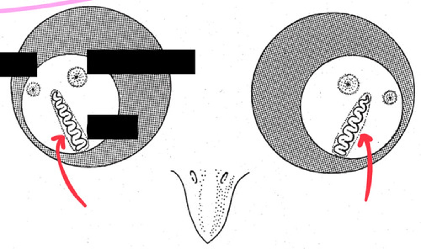 <p>The __________________ is a unique eye structure in birds. It is found in the fundus and provides nutrients to the retina and vitreous body. The red arrows are pointing to it in this picture.</p>