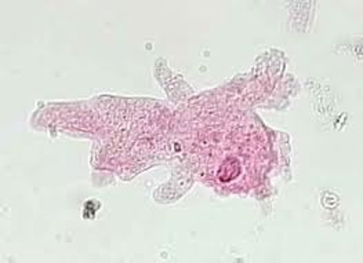 <p>protist that moves and feeds with the help of pseudopods</p>