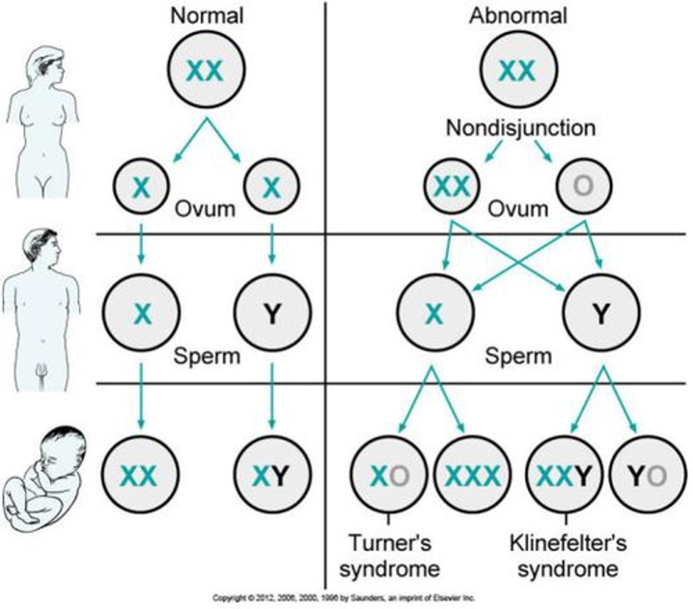 <p>When an organism has the incorrect number of chromosomes (ie, a monosomy or trisomy disorder)</p>