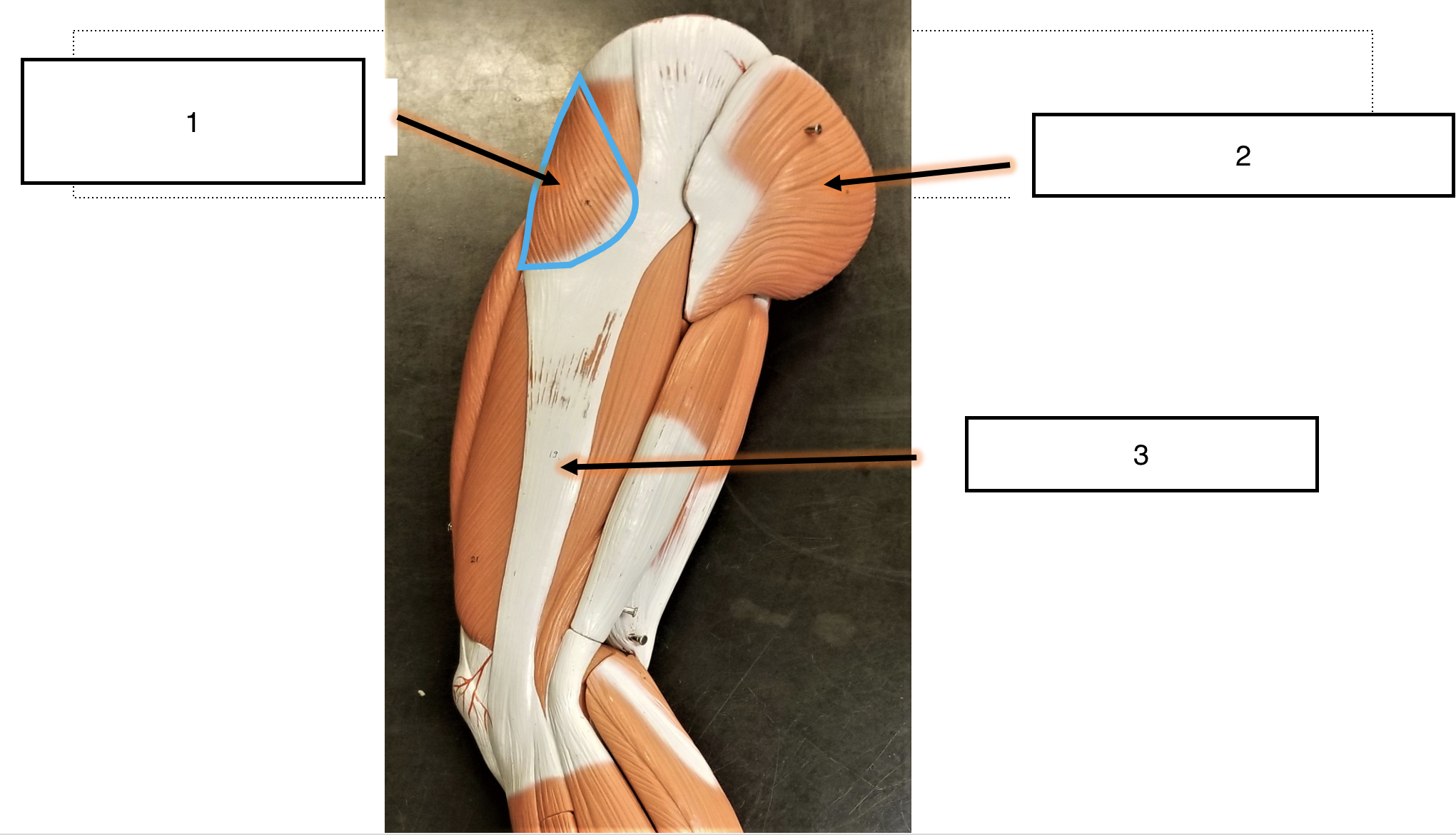 <p>name the muscle (2)</p>