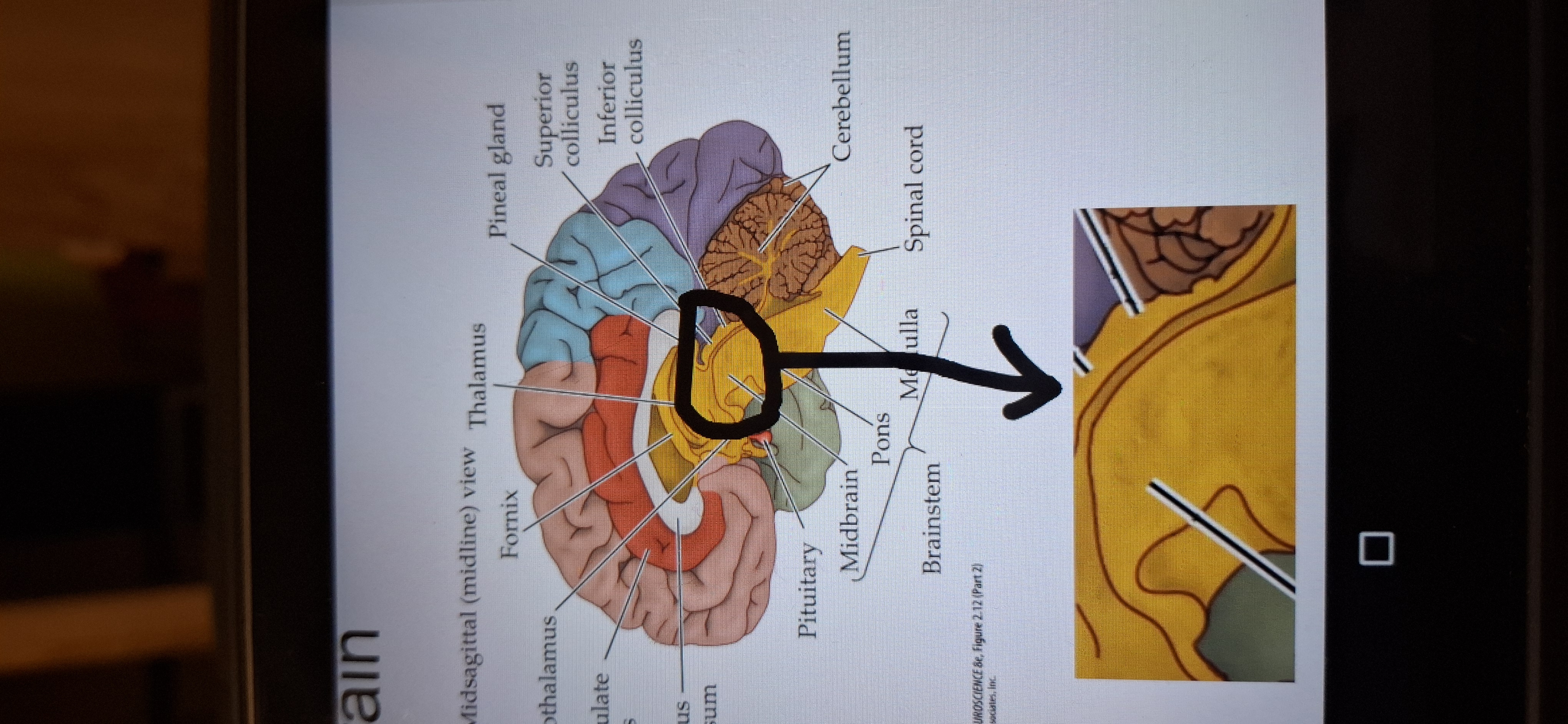 <p>Superior and inferior colliculi make it up.</p>