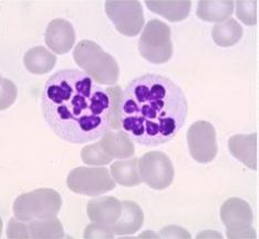 <ul><li><p>nuclei with 5 or more lobes</p></li><li><p>can be due to aging neutrophils</p></li><li><p>common in poodles w macrocytosis </p></li></ul><p></p>