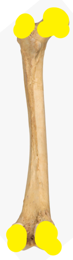 <p>Identify this bone part.</p>