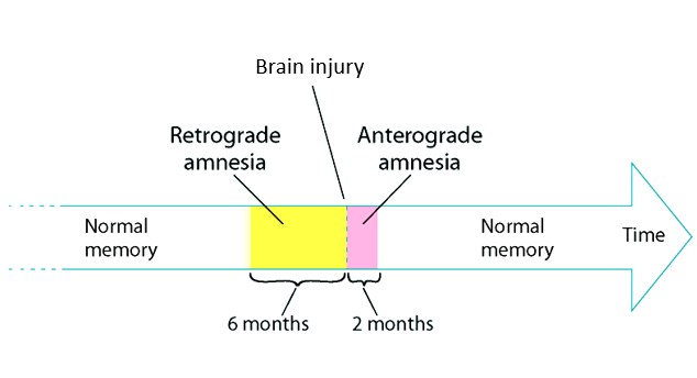 <p>inability to make new memories after the brain injury, about 2 months of effects</p>