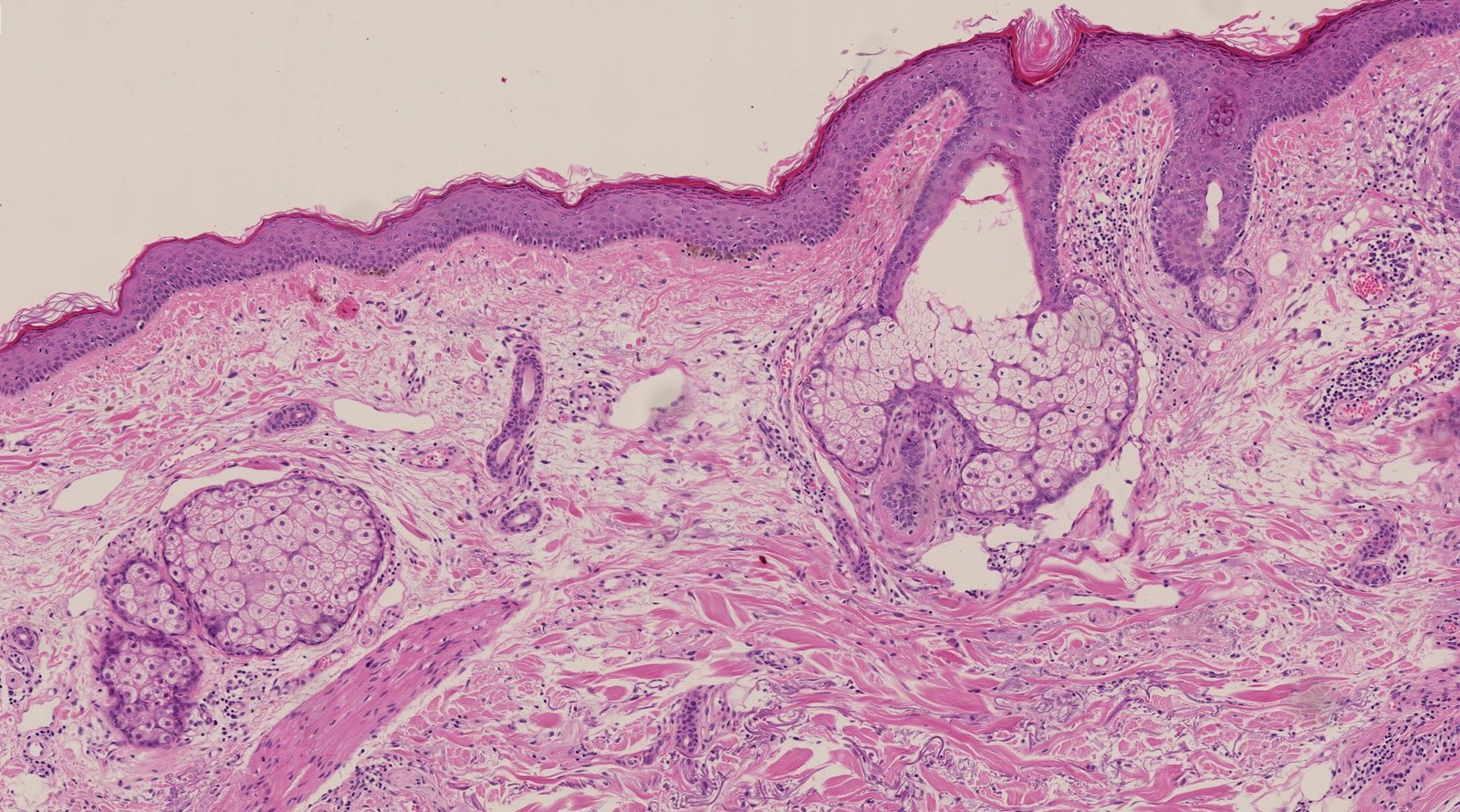 <p>A. Develop increasingly pyknotic nuclei during their differentiation</p>