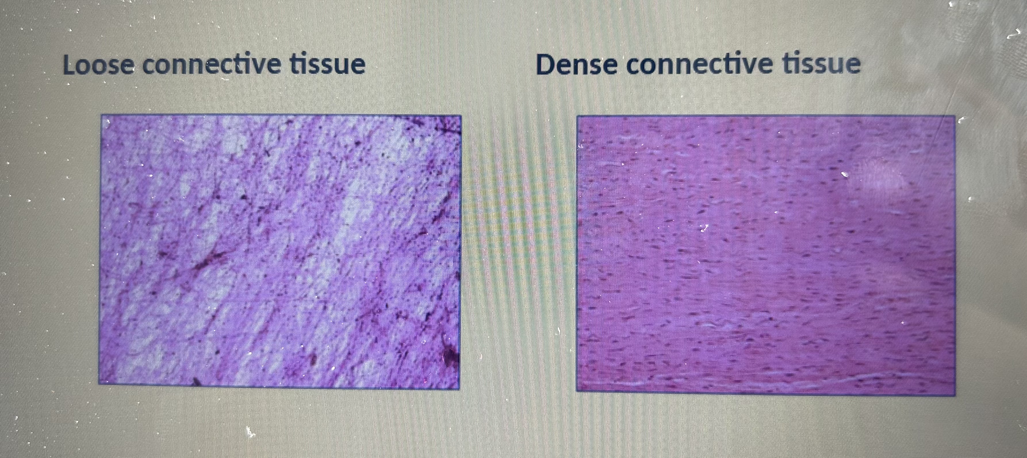 <p>loose - lots of gaps, not a lot of extracellular matrix / in structures that are elasticated, flexible and that expand and collapse easily </p><p>dense - packed together neatly, more organized structure / aorta to withstand high blood pressure </p>