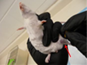 <p>Saphenous Veins</p>