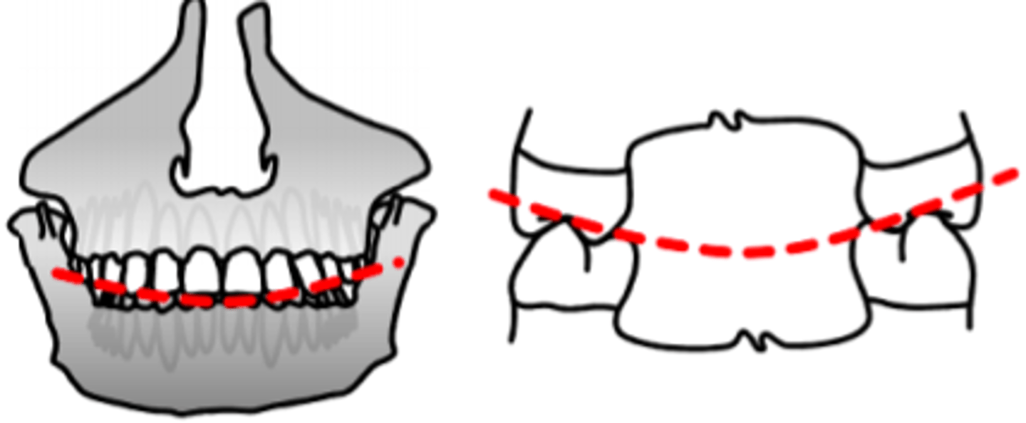 <p>Frontal ocklusionskurva</p><p>- Buckolinguala förhållandet mellan lutningen i ök och uk tänder</p><p>- förbinder höger och vänster sidas kindtänder i frontalplanet</p><p>- Ju längre bak desto större lutning</p>