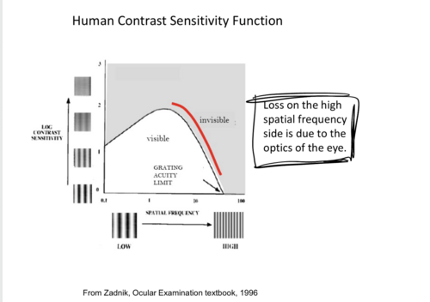 <p>What is the loss of contrast sensitivity on the high spatial frequency side d/t?</p>