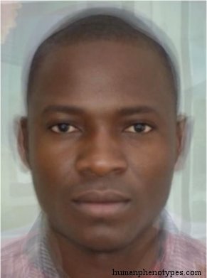 <p>Identify this Phenotype</p>