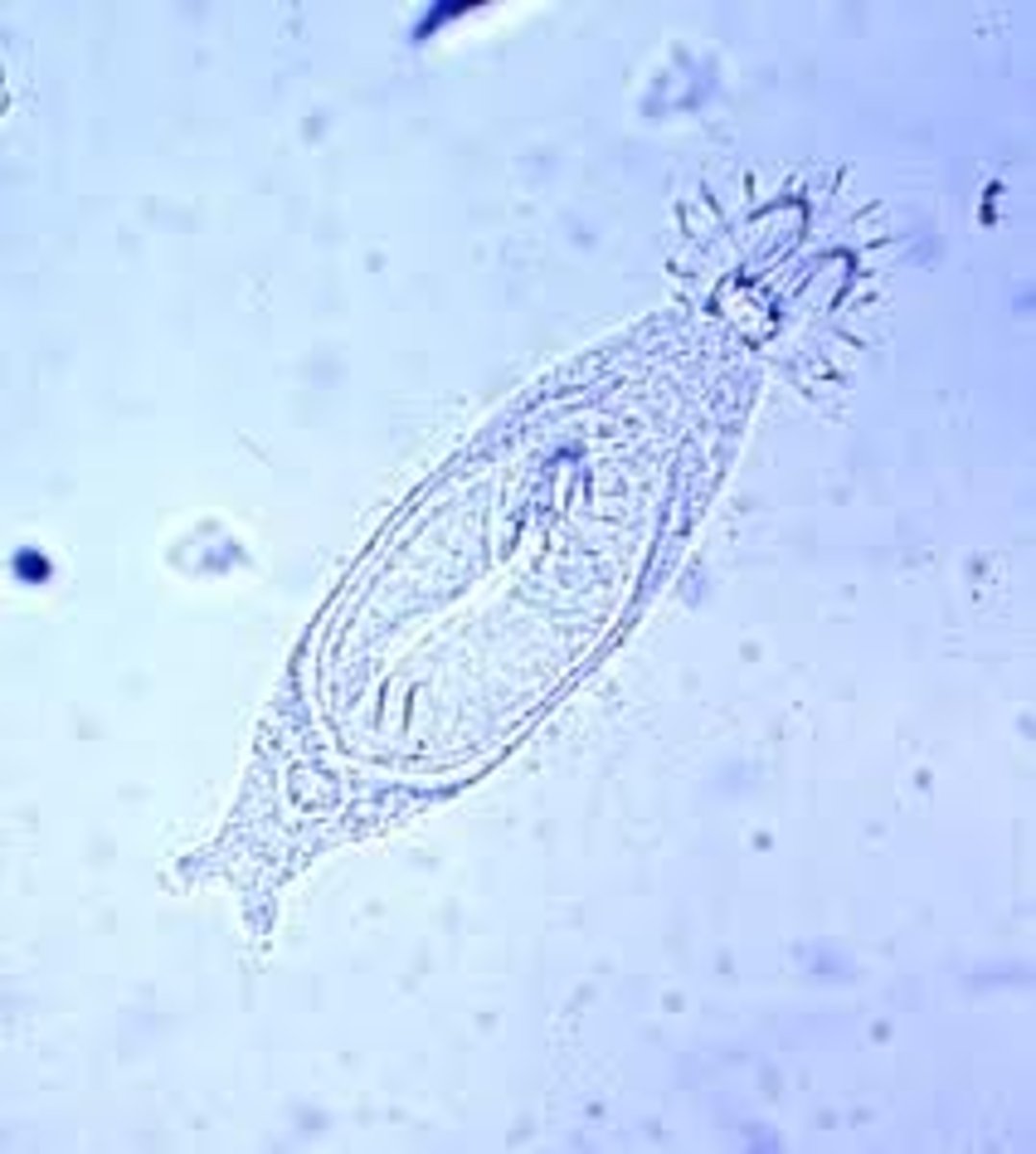 <p>Is this an ectoparasite, or an endoparasite?</p>