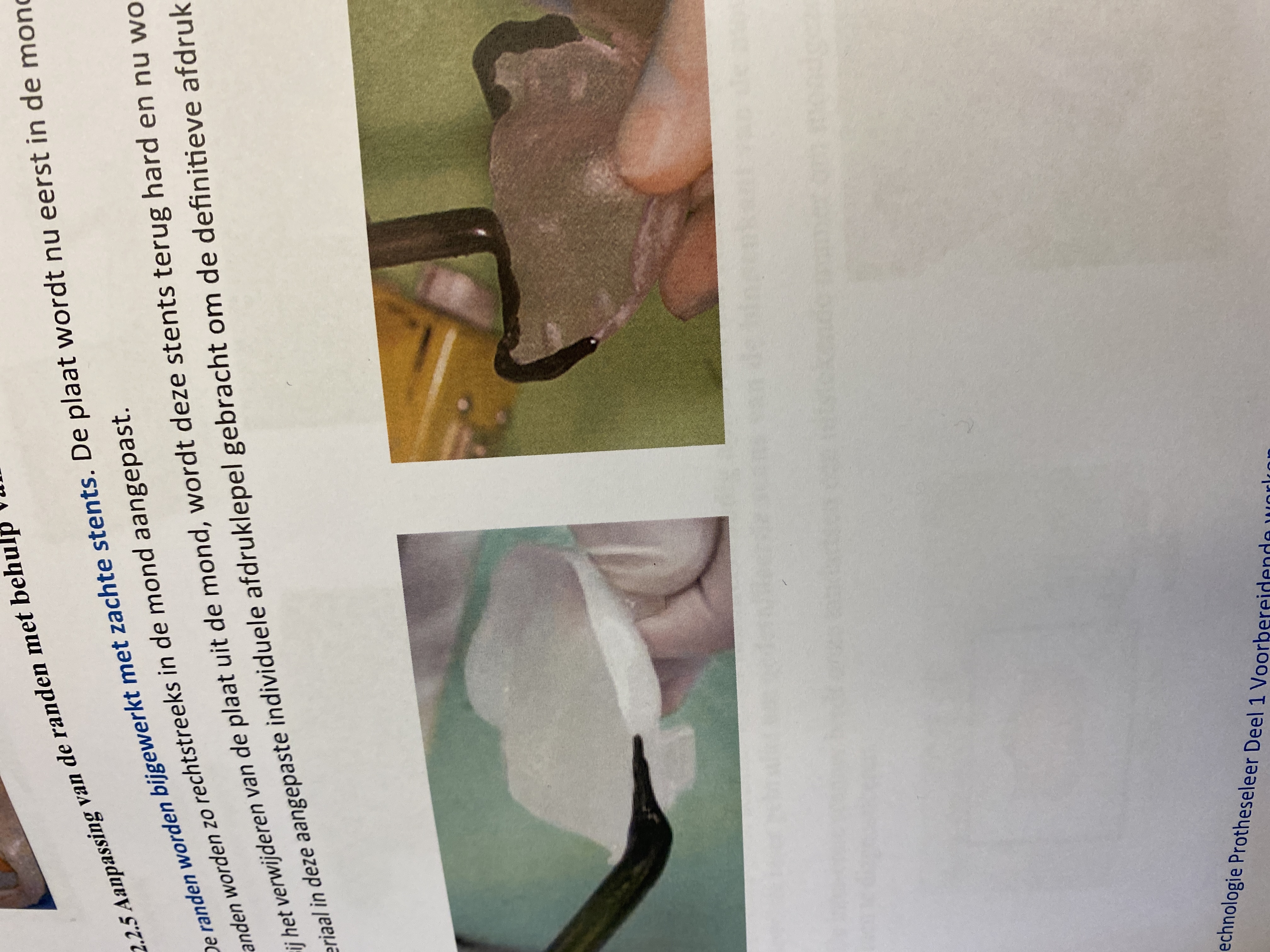 <p>Wat is de werking van aanpassing vd randen mbv stens of compound </p>