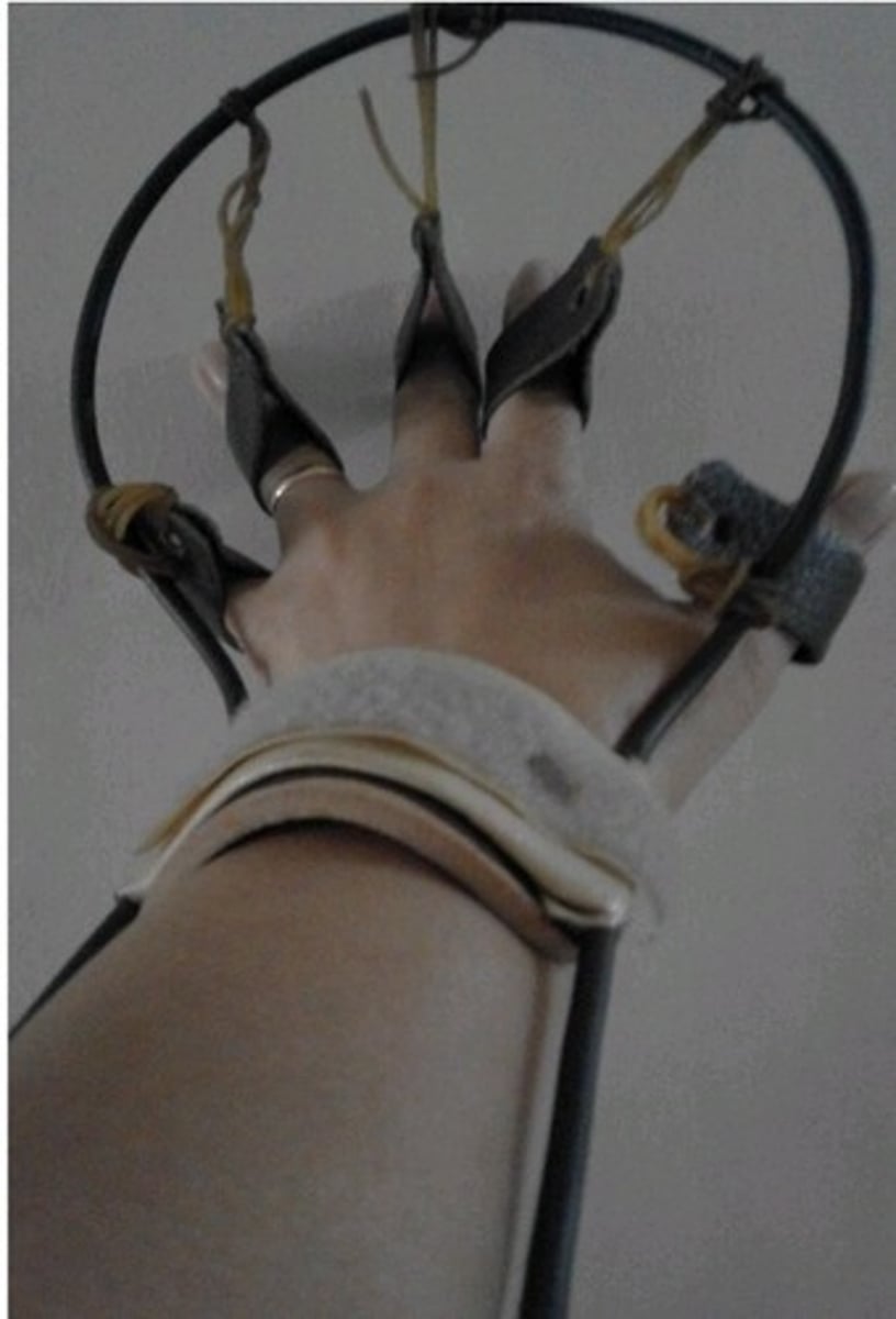 <p>for peripheral nerve injury</p>